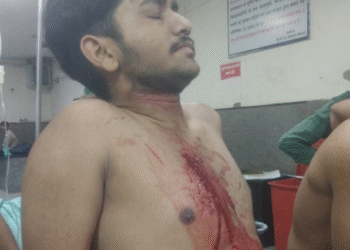 बीकानेर के गंगाशहर थाना क्षेत्र में एक बार फिर हुई चाकूबाजी: तीन युवक घायल, पीबीएम अस्पताल में भर्ती