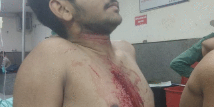 बीकानेर के गंगाशहर थाना क्षेत्र में एक बार फिर हुई चाकूबाजी: तीन युवक घायल, पीबीएम अस्पताल में भर्ती