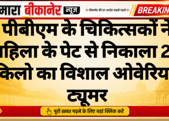 पीबीएम के चिकित्सकों ने महिला के पेट से निकाला 20 किलो का विशाल ओवेरियन ट्यूमर