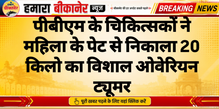 पीबीएम के चिकित्सकों ने महिला के पेट से निकाला 20 किलो का विशाल ओवेरियन ट्यूमर