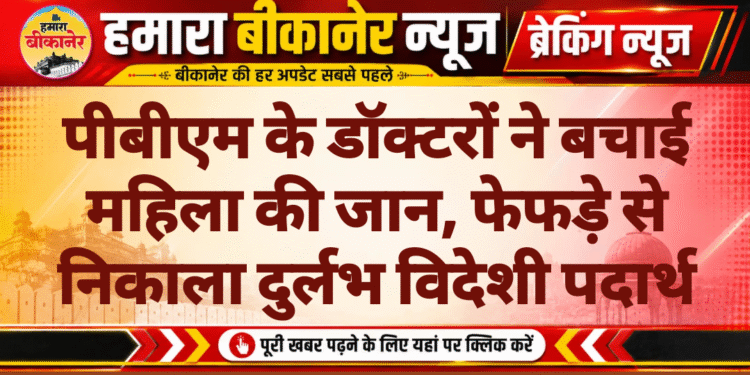 पीबीएम के डॉक्टरों ने बचाई महिला की जान, फेफड़े से निकाला दुर्लभ विदेशी पदार्थ